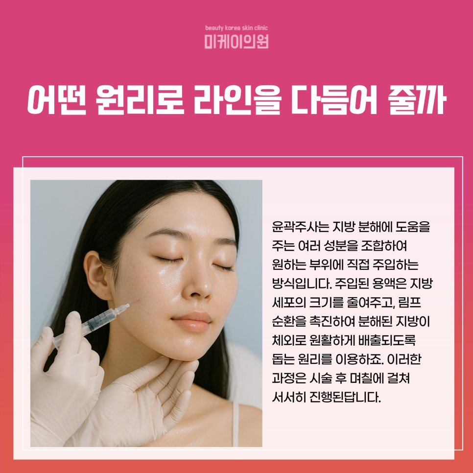 서초구 윤곽주사 부위 얼굴형에 따라 달라 관련 이미지 2