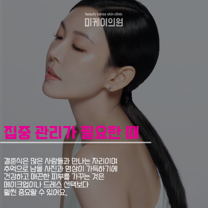 결혼식 전 피부과 시술 필수인 이유 관련 이미지 2