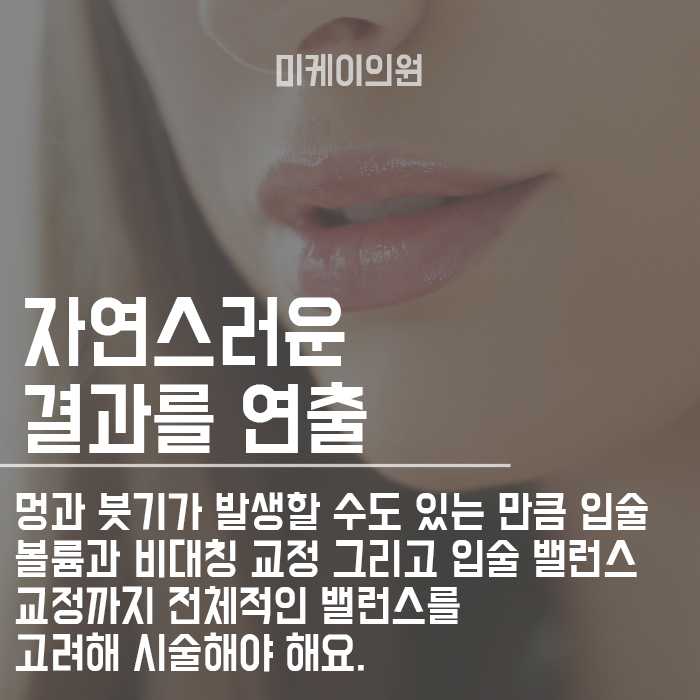서초동입술필러로 사랑스러운 입모양 관련 이미지 4