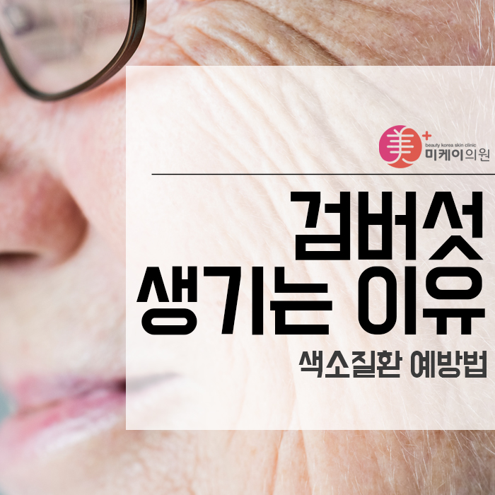 검버섯생기는 이유 예방법 관련 이미지 1