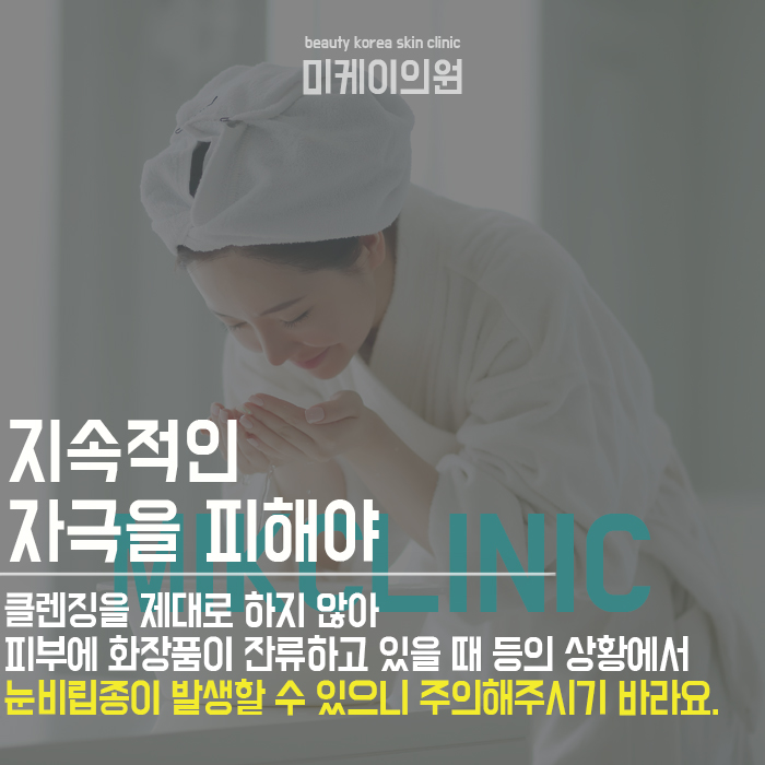 눈비립종원인 및 관리 방법 알아보자 관련 이미지 4