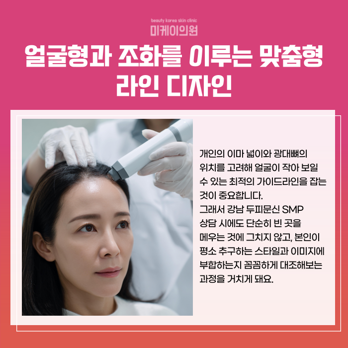 강남 두피문신 SMP 정수리와 이마 고민 관련 이미지 3