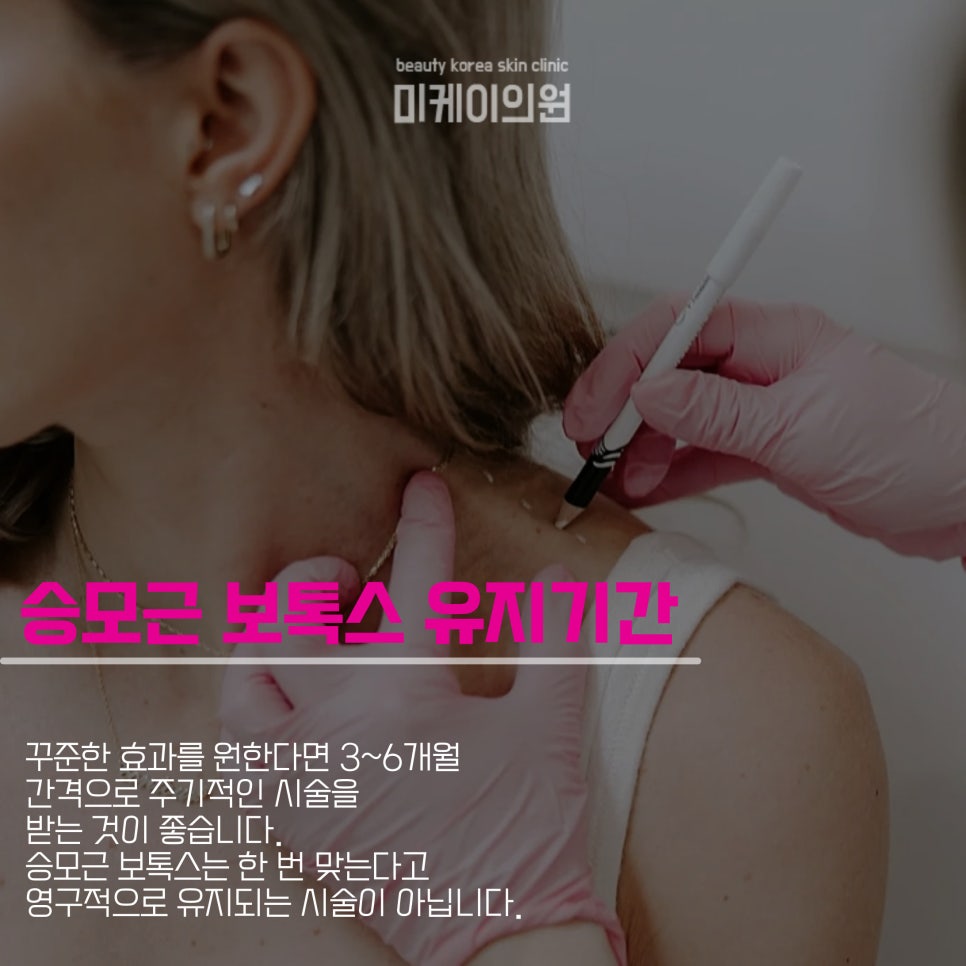 Learn About the Duration and Precautions of Trapezius Botox image 4