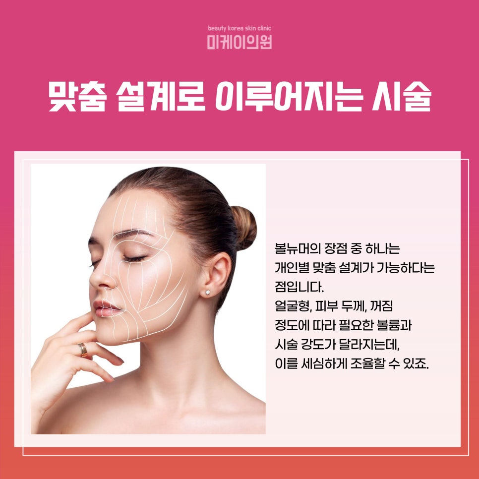 Volnewmer 600 Shots: Effects That Improve Firmness and Volume at the Same Time image 3