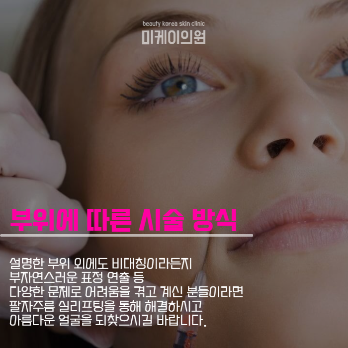 팔자주름실리프팅 날렵한 얼굴 라인 관련 이미지 4