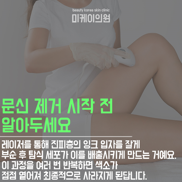 강남역문신제거병원 제대로 선택하려면? 관련 이미지 3