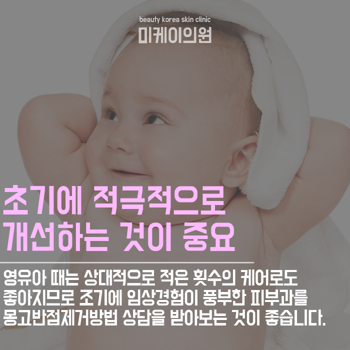 몽고반점제거방법 개인의 피부 타입을 고려해야 관련 이미지 4