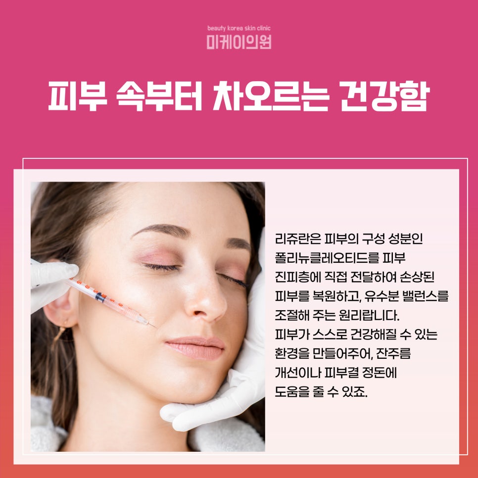 Top 3 Recommended Skin Procedures for Winter image 2