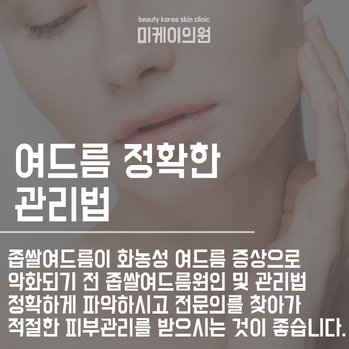 서초구피부관리 좁쌀여드름원인 및 관리법 초기부터 관련 이미지 4