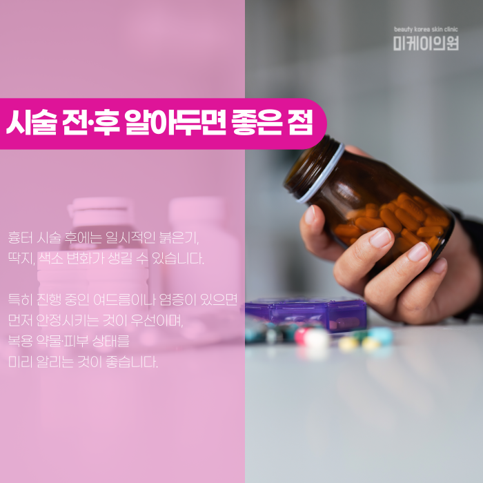 Why Don’t Gangnam Acne Scars Disappear on Their Own? image 6