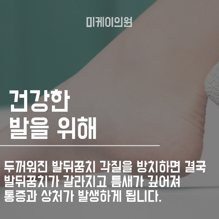발뒤꿈치 갈라짐 원인 파악하고 해결해봐요! 관련 이미지 4