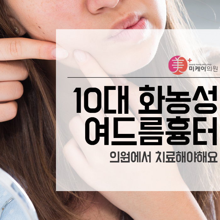 10대 화농성여드름흉터 의원에서 치료해야해요 관련 이미지 1