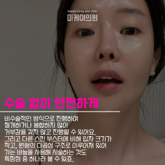 쥬베룩볼륨효과 나에게 맞는 시술 찾기 관련 이미지 4