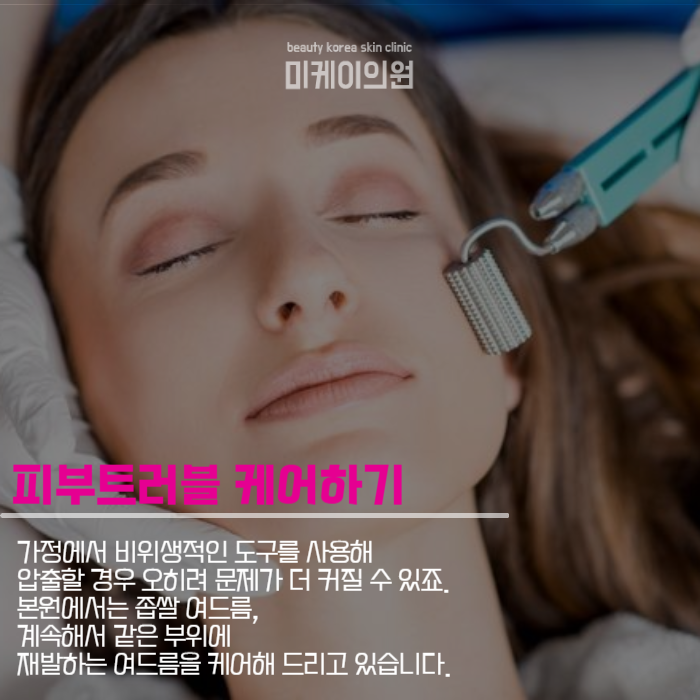 강남역여드름관리 병변부터 흉터까지 관련 이미지 4