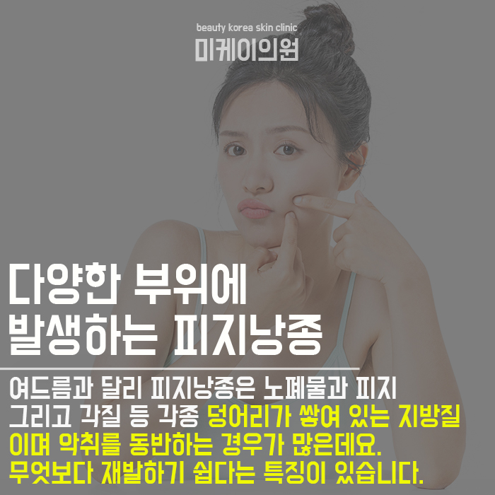 피지낭종원인증상 체계적으로 관리하려면 관련 이미지 2