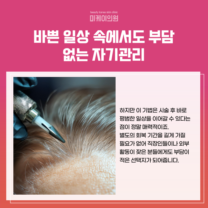 강남 두피문신 SMP 정수리와 이마 고민 관련 이미지 4