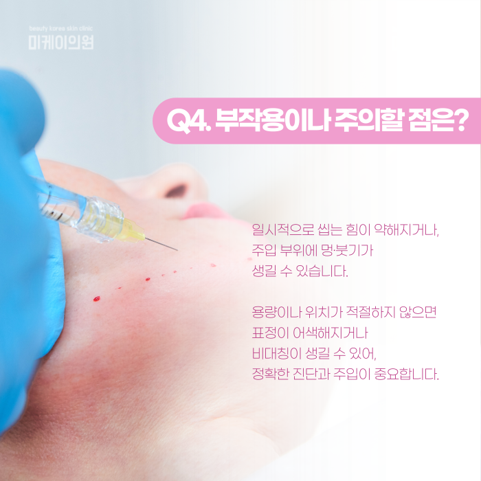사각턱보톡스 효과 있는 사람, 따로 있을까? 관련 이미지 5
