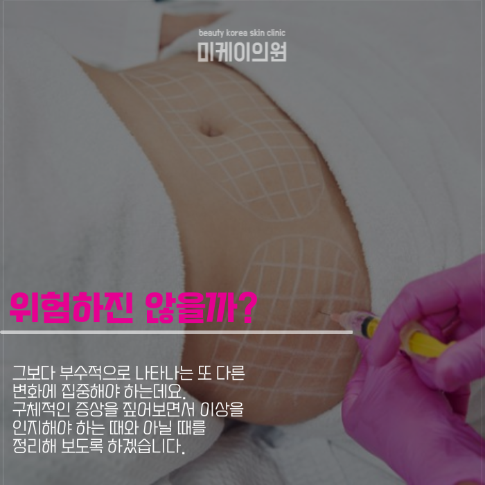 카복시 부작용 걱정 안고 시작해도 될까? 관련 이미지 4