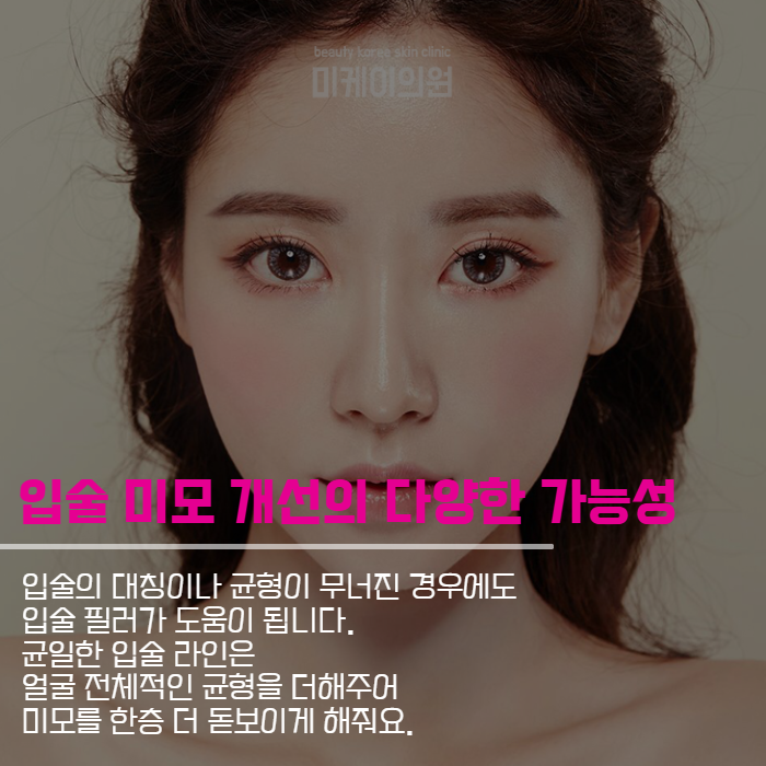 신논현역입술필러 특별한 매력 관련 이미지 5