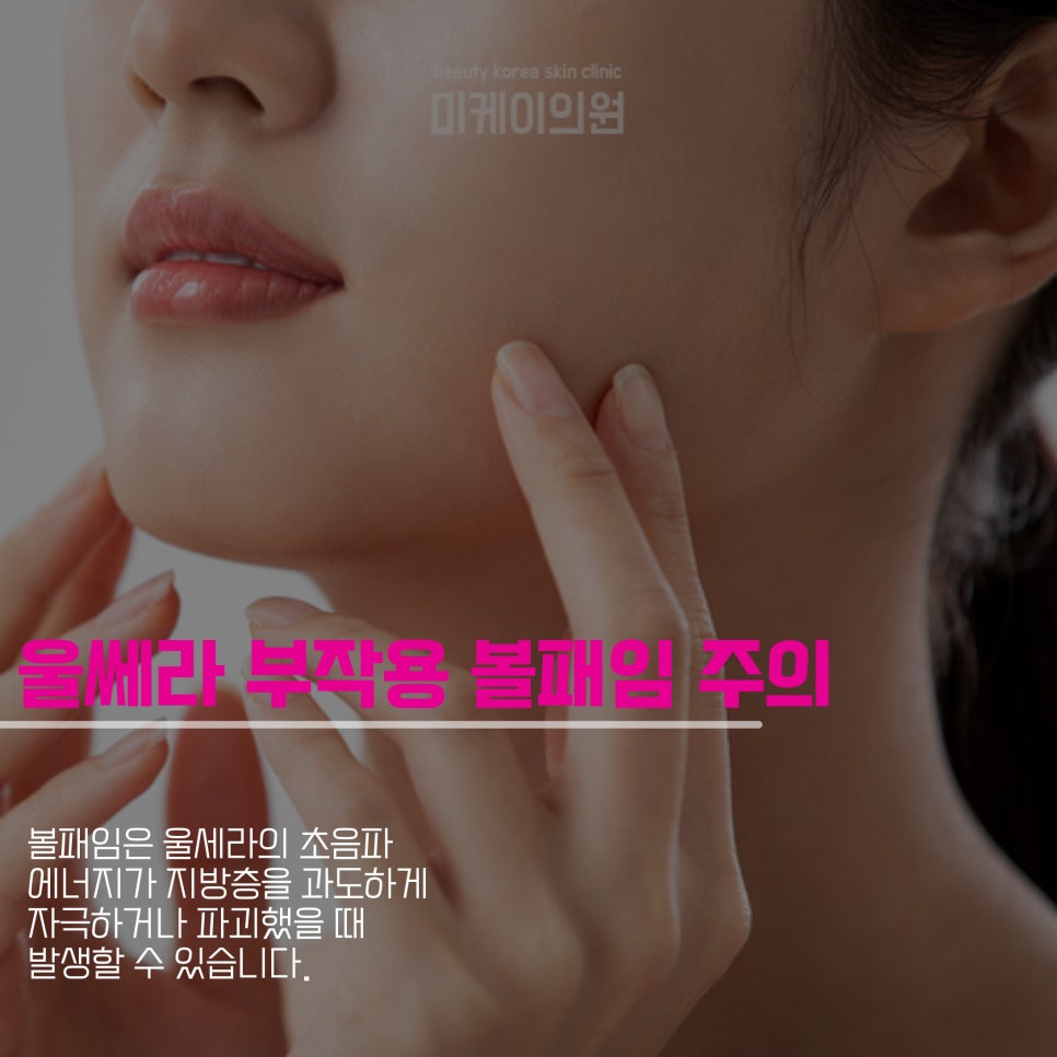 울쎄라 부작용 볼패임 미리 알아두기 관련 이미지 5