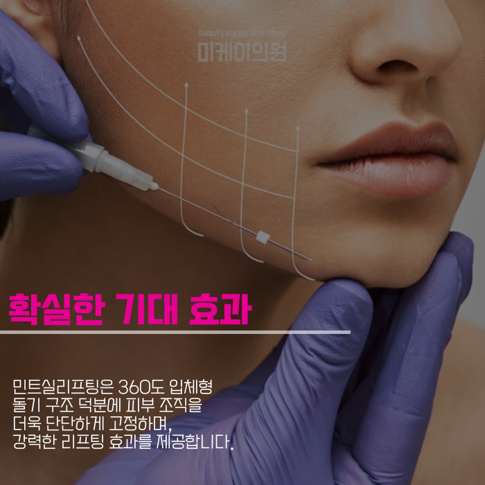 강남 민트실리프팅 빠르고 확실한 변화 관련 이미지 5