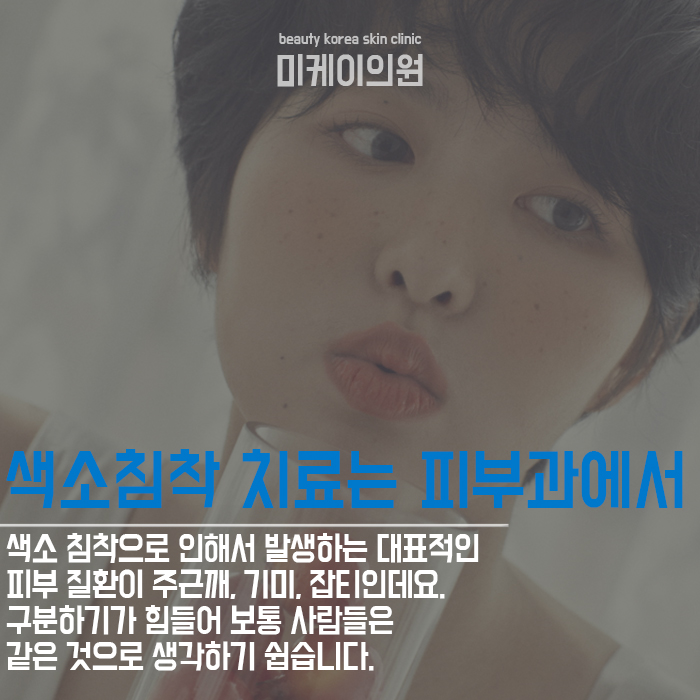강남역 레이저토닝 오랜 고민 색소침착 해결! 관련 이미지 3