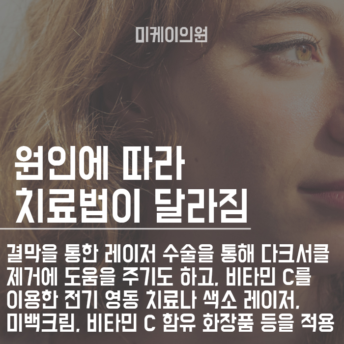 다크서클화장법 이렇게 가려보세요! 관련 이미지 2