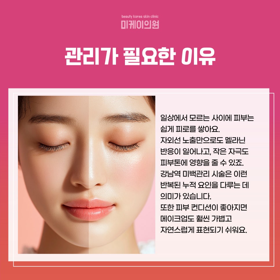 강남역 미백관리 시술로 피부 톤 밝히자 관련 이미지 3