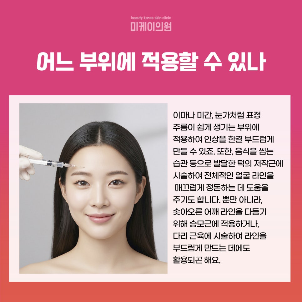 강남역 보톡스 효과 지속기간 알아보기 관련 이미지 3