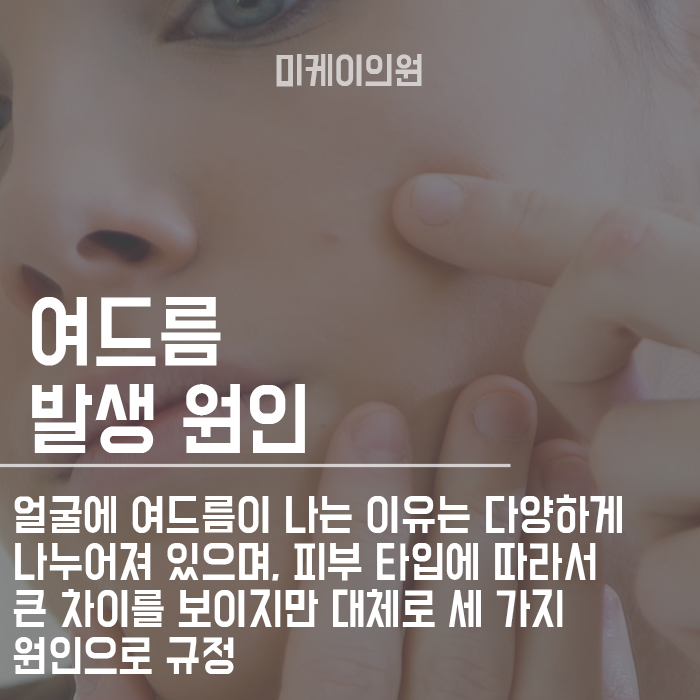 이마여드름흉터치료 이제 방치하지 마세요 관련 이미지 2