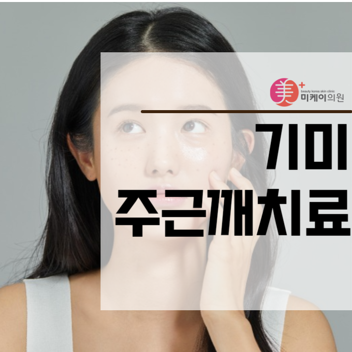 기미주근깨치료로 피부 건강과 자신감을 동시에 관련 이미지 1