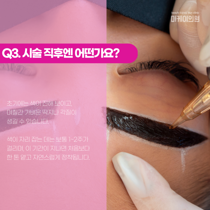 강남 눈썹문신, 어떤 기법이 나에게 맞을까? 관련 이미지 4