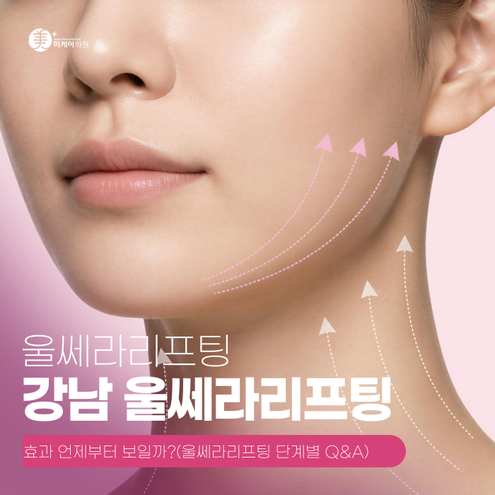 Gangnam Ultherapy Lifting: When Do the Effects Start to Show? image 1