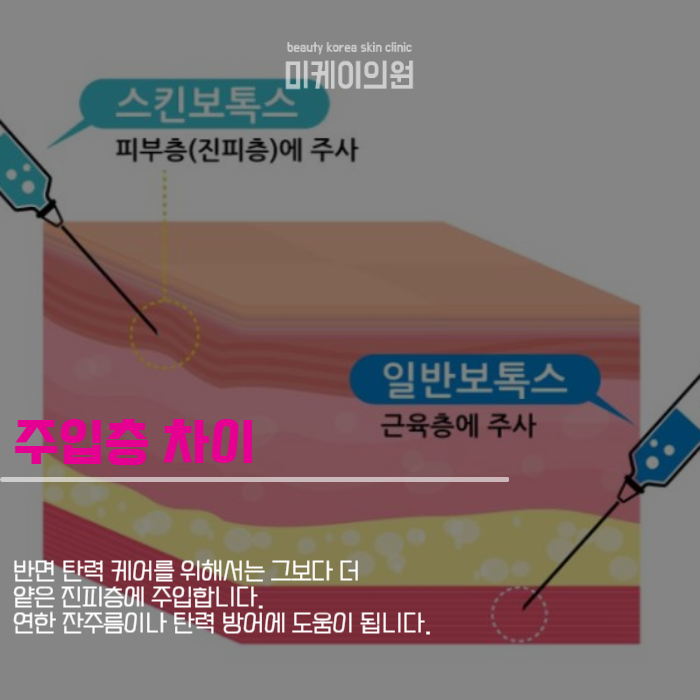 The Different Types of Skin Botox Are Different Once You Understand Them image 2