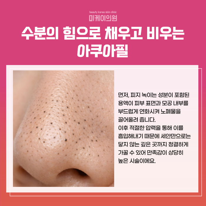 Clear and Smooth Skin with Aqua Peel for Blackhead Care in Gangnam image 3