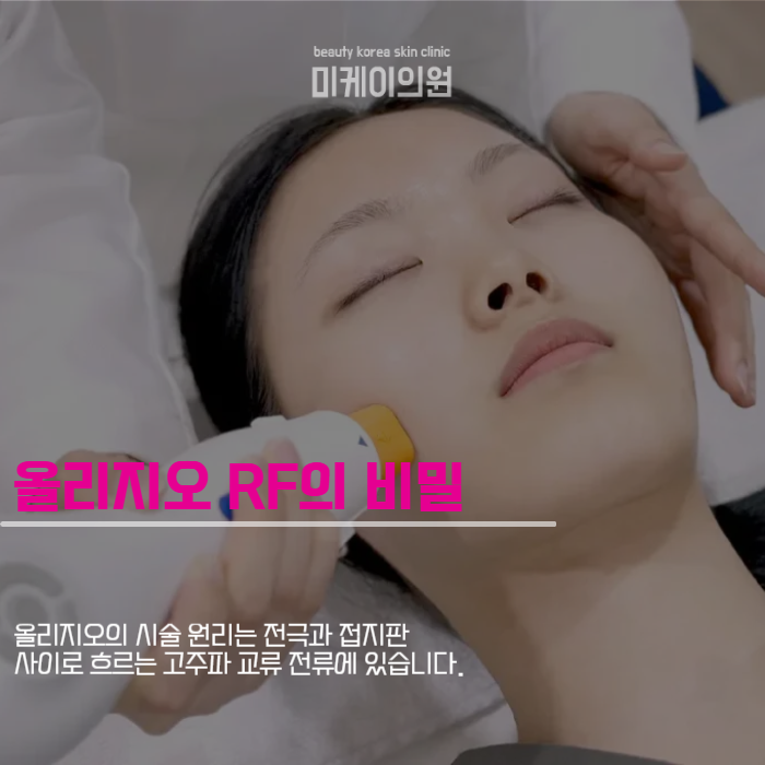 Oligio Treatment Intervals for a Smooth Facial Line image 2