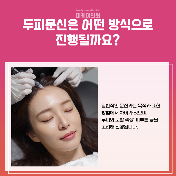 강남역 두피문신 자연스러운 빽빽한 헤어라인 관련 이미지 2