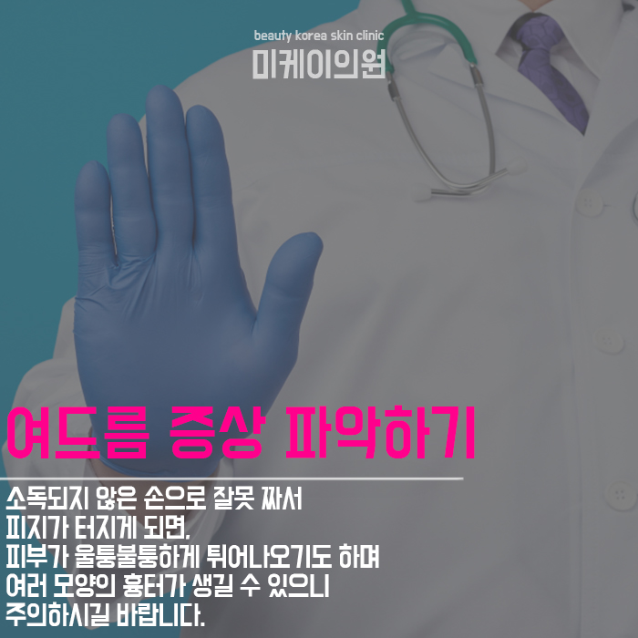 강남여드름관리 원인부터 바로잡자 관련 이미지 3