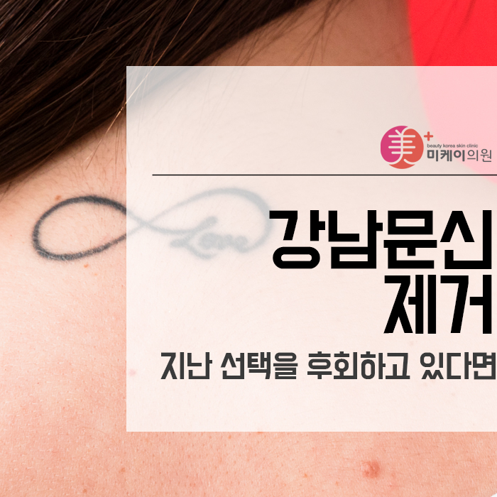 강남문신제거 지난 선택을 후회하고 있다면 관련 이미지 1