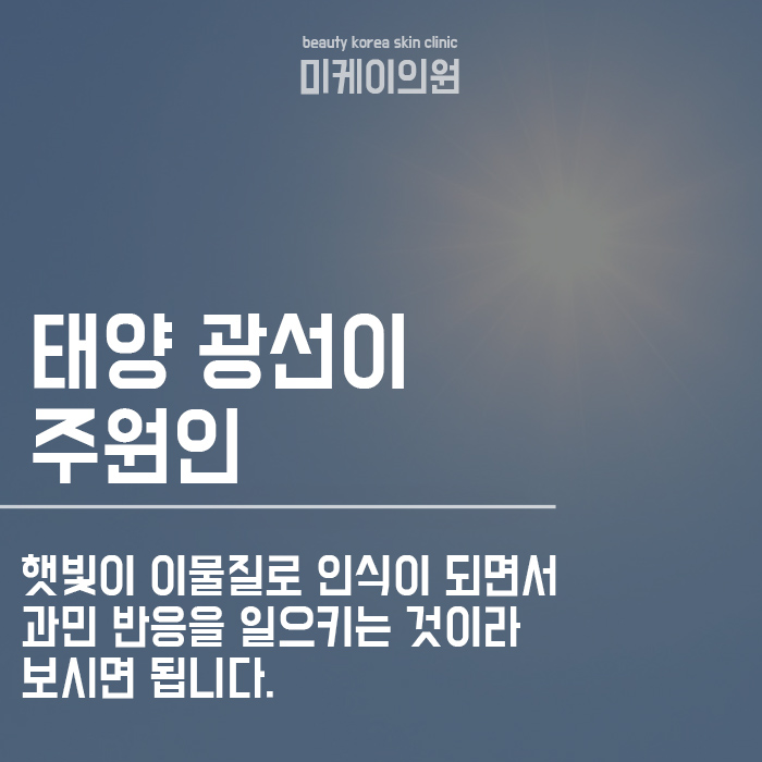 햇빛 알레르기 증상 및 원인 A~Z 알아보기 관련 이미지 3