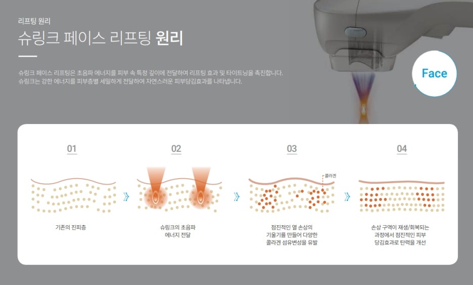 서초아이슈링크 눈가 주름 탄력은 미케이의원 관련 이미지 6