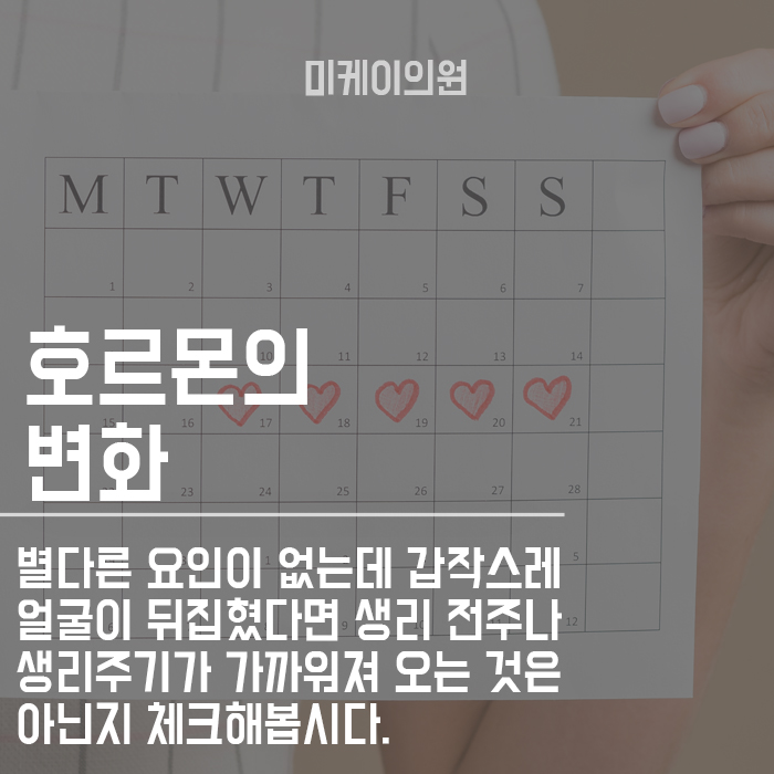 피부뒤집어졌을때 집에서 진정시키는 꿀팁! 관련 이미지 6
