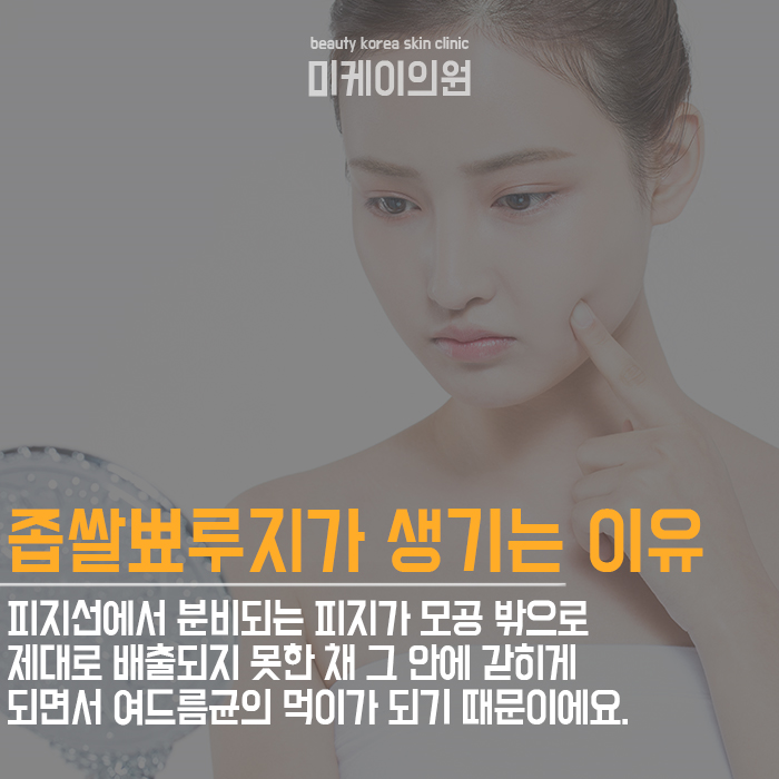 좁쌀뾰루지예방 평소 습관과 관리가 중요해요 관련 이미지 2