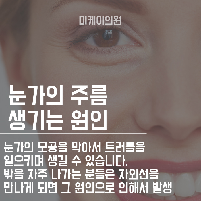 아이슈링크 탄력있고 생기있는 눈매를 위해 관련 이미지 2