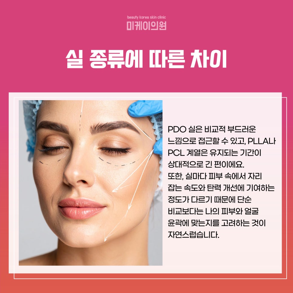 Natural Lifting at a Clinic Near Gangnam Station with Thread Lifting image 3