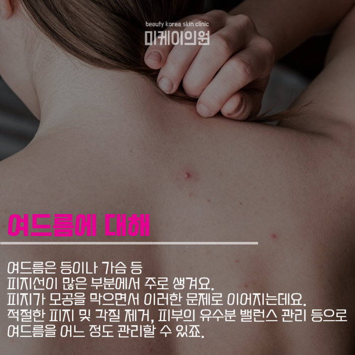 프락셀레이저 통증 부터 원리까지 관련 이미지 2