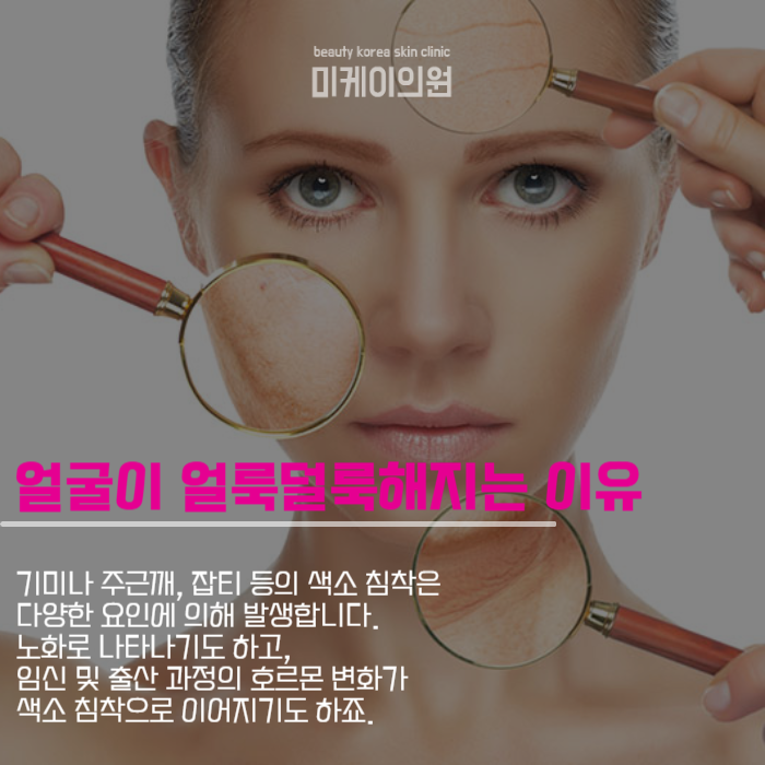 강남레이저토닝 깨끗함과 탄력을 동시에 관련 이미지 2