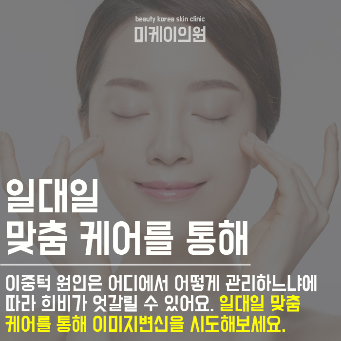 이중턱 원인 이제는 알아야 관련 이미지 6