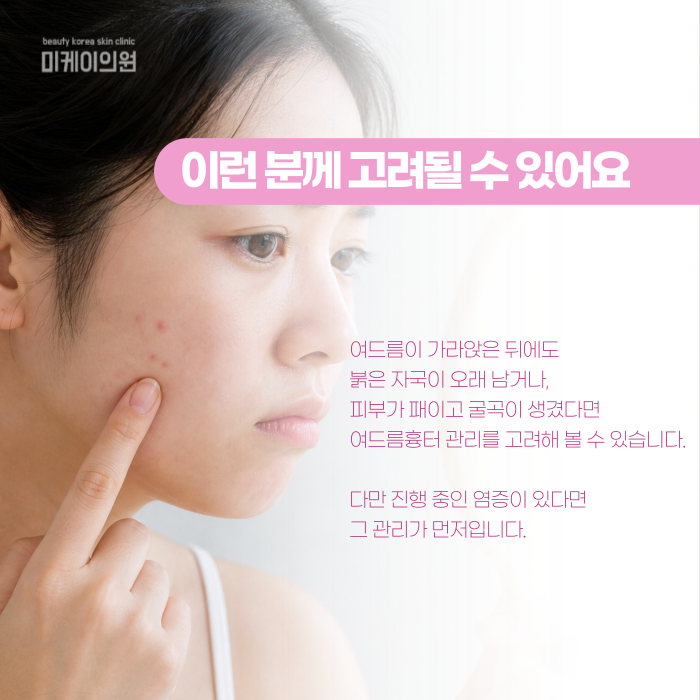 Why Don’t Gangnam Acne Scars Disappear on Their Own? image 5