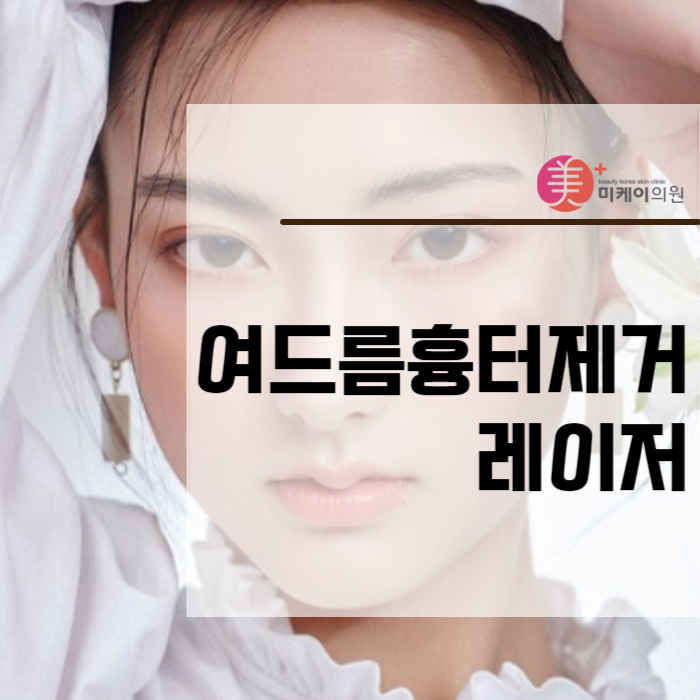 여드름흉터제거레이저 짧은 시간에 간단하게 관련 이미지 1